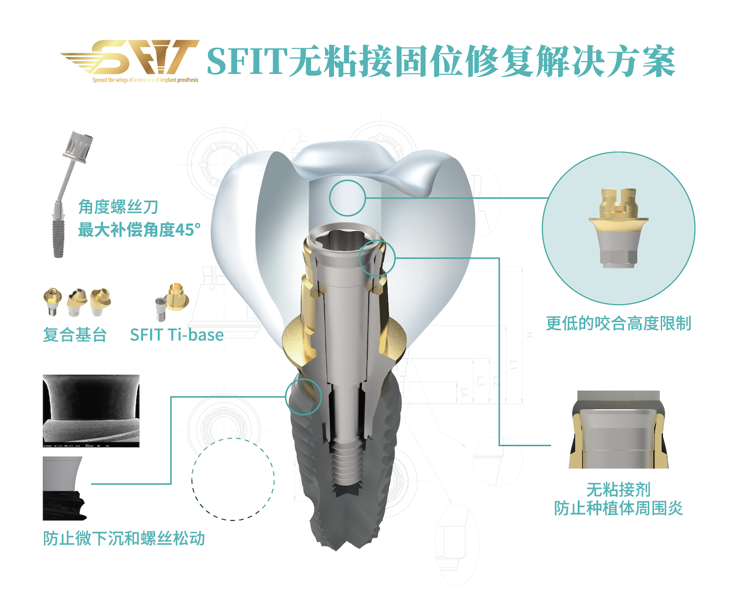 柯威尔种植系统以数字化种植技术创新赋能口腔种植修复新高度
