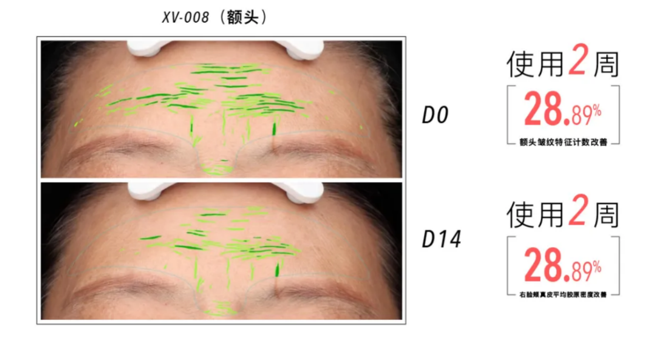 子菁聚焦皮肤免疫抗衰赛道，自研胶原蛋白肽，打造科学抗衰护肤新篇章