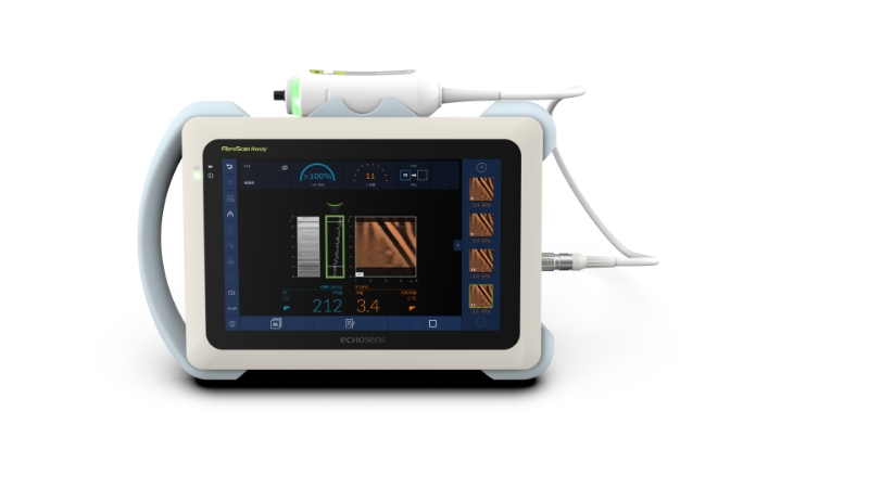 檀健次、张雨绮答案翻车，听专家现场用AI技术FibroScan®福波看诊断脂肪肝致命真相