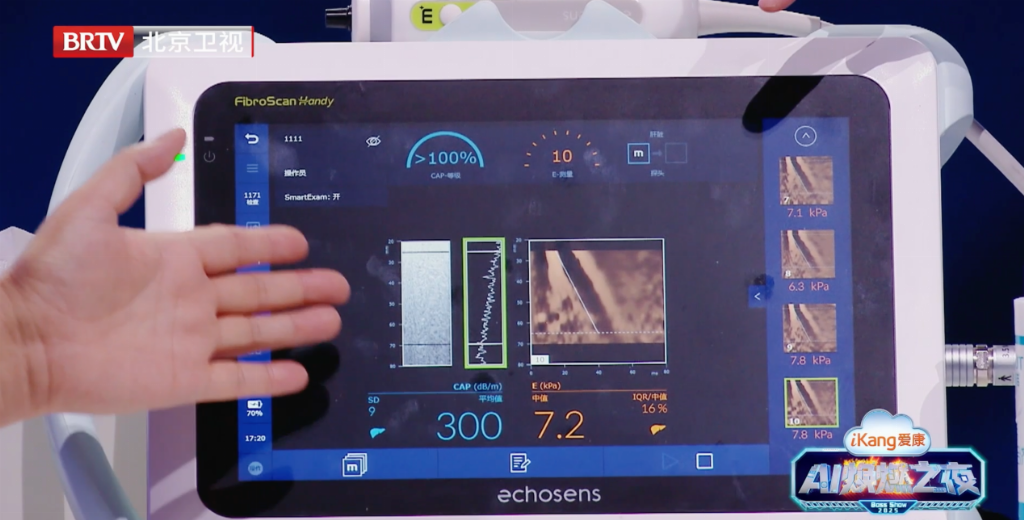 檀健次、张雨绮答案翻车，听专家现场用AI技术FibroScan®福波看诊断脂肪肝致命真相