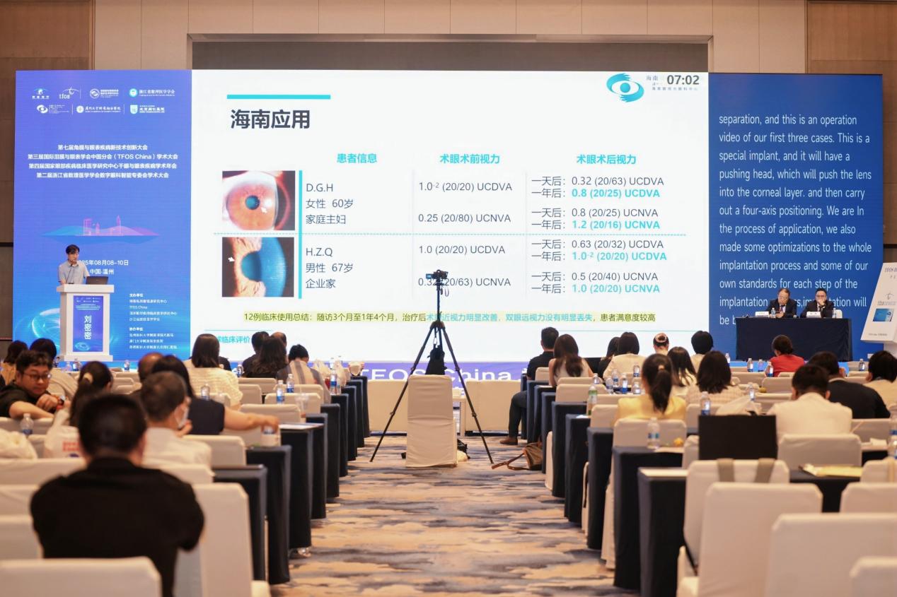 PRESBIA FM微透镜闪耀2025TFOS China学术会，共启老花眼矫正新篇章